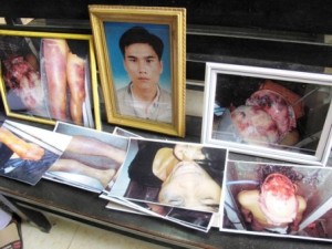 Nhung - Những căn bệnh đang hủy hoại xã hội Việt Nam 06-cc3a1c-co-quan-n_i-t_ng-c_a-anh-ki_u-d_u-b_-t_n-thuong-n_ng-_nh-nlc3b0